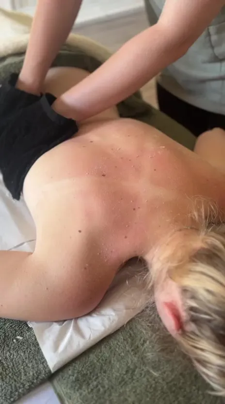Body exfoliation treatment
